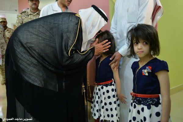 التوأم السيامي السعودي رنا ورنيم