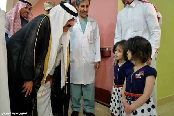التوأم السيامي السعودي رنا ورنيم