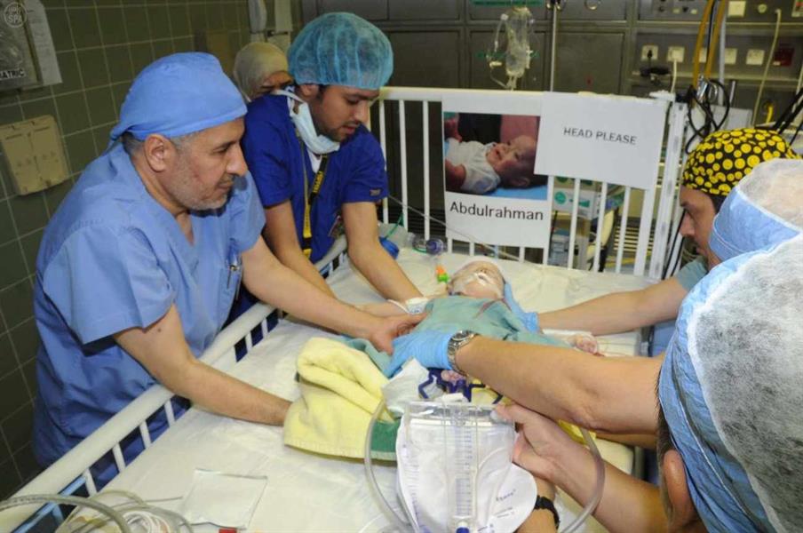 التوأم السيامي اليمني عبدالله و عبدالرحمن التوأم السيامي اليمني عبدالله و عبدالرحمن