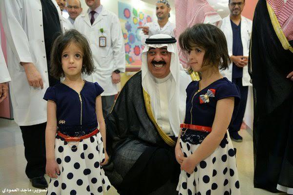التوأم السيامي السعودي رنا ورنيم